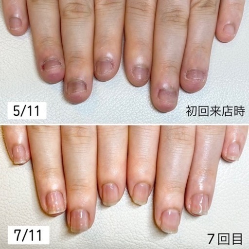 ネイルケアのみで地爪を縦長の美爪にする育成モニター様募集 3ヶ月間集中コース 5名様限定 残枠2名様です Smile 二川のネイルの無料広告 無料掲載の掲示板 ジモティー ネイルケアのみで地爪を縦長の美爪にする育成モニター様募集 3ヶ月間集中コース 5名様限定 残枠2名様です Smile 二川のネイルの無料広告 無料掲載の掲示板 ジモティー