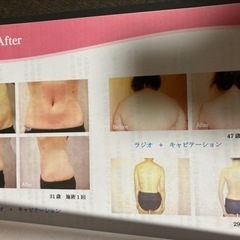 値下げ美容機器 エステマシーン キャビテーション RF