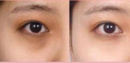 目の黒いクマ悩んでる方必見 東洋経絡 おもろまちのマッサージの無料広告 無料掲載の掲示板 ジモティー