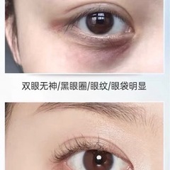 目の黒いクマ悩んでる方必見 東洋経絡 おもろまちのマッサージの無料広告 無料掲載の掲示板 ジモティー