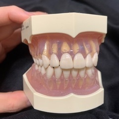 歯の模型　NISSIN