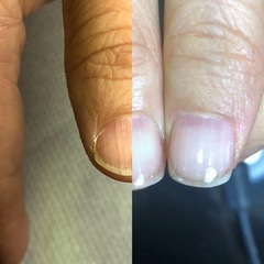 縦長のキレイなお爪に育てませんか💅 - 奈良市