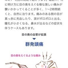 群発頭痛について