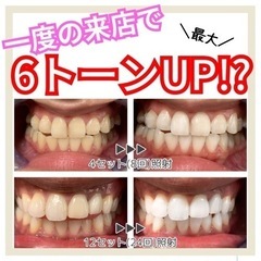 🦷セルフホワイトニング【¥980】