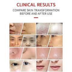 新品　７色LED　エステ　美顔器