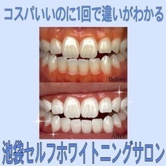 【11,500円割引中】歯のホワイトニング☆3,900円 激安＠池袋 - 美容