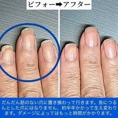 【健康な爪】が指を支えています　ハンドケア＆ネイルケア桃の木 - ボディケア