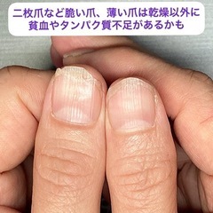 【健康な爪】が指を支えています　ハンドケア＆ネイルケア桃の木 − 東京都