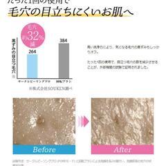 ヤーマン　サークルピーリングプロ　毛穴