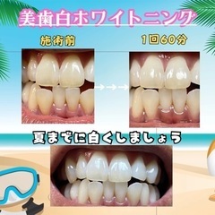 🌈今年の夏は☀️白い歯で❣️口臭予防❗️虫歯対策😊