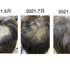 塚本駅徒歩2分🚶頭皮改善・薄毛予防に【強髪プログラム】今話…